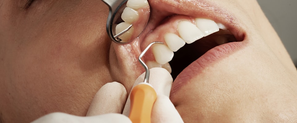 orthodontic aligners microplastics hero image